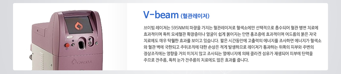 v-beam